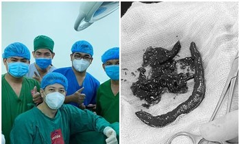 Phát hiện đỉa trong dương vật một người đàn ông, bác sĩ phẫu thuật “chết sững“