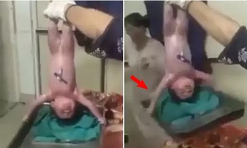 Video em bé "siêu nhân", vừa ra đời đã nhấc bổng khay kim loại như lực sĩ khiến y tá kinh ngạc