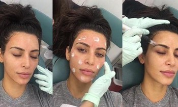 4 phương pháp làm đẹp đau đớn của Kim Kardashian: "Mặt nạ ma cà rồng" gây khiếp sợ