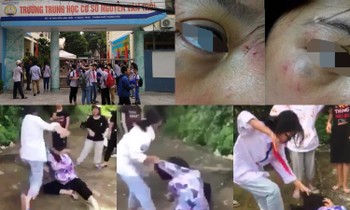 Bị nhóm bạn quây đánh hội đồng, nữ sinh lớp 8 ở Thanh Hóa phải nhập viện