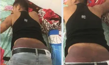 Cứu nam thanh niên nguy kịch vì bị chích điện, tra tấn
