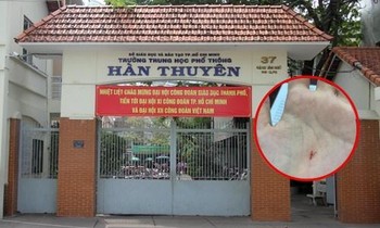 Vụ việc thầy giáo Vật Lý dùng compa đâm chảy máu tay học sinh: Hình thức xử lý ra sao?