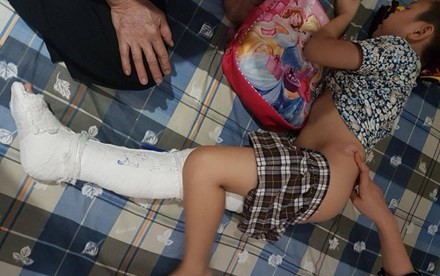 Có thể khởi tố vụ học sinh bị ô tô đâm gãy chân