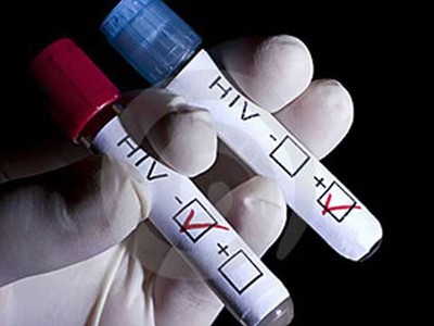 Triệu chứng HIV có thể điều trị được không?