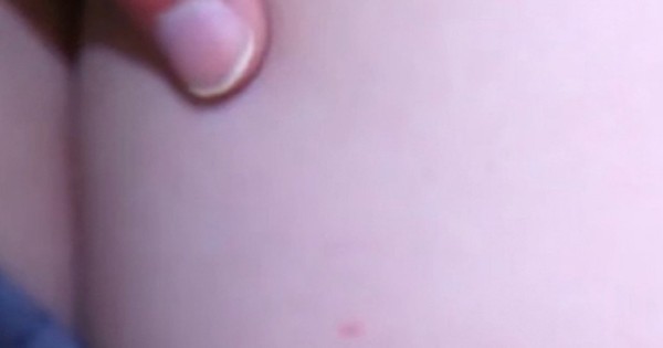 Lý do tiêm vaccine vào mông em bé thay vì cánh tay? 
