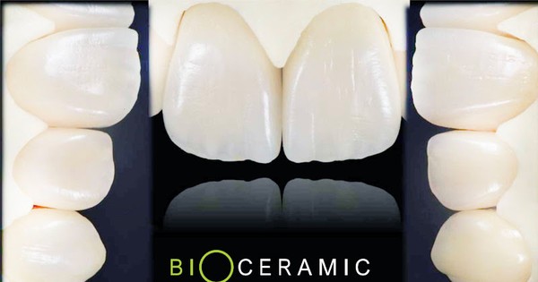 Cách bảo quản và làm sạch răng sứ ceramic như thế nào?
