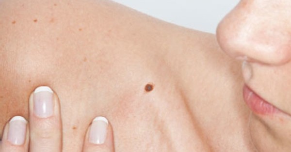 Có cách nào để nhận biết nắm bắt những thông điệp mà nốt ruồi ở vị trí ngực mang lại không?
