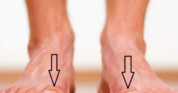 Những thuốc đau má trong bàn chân nào được sử dụng phổ biến?
