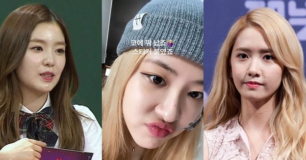 Khi Idol Bị Mụn Tấn Công: Nữ Thần Như Yoona, Irene Mất Điểm Còn Rosé Được  Khen Dễ Thương