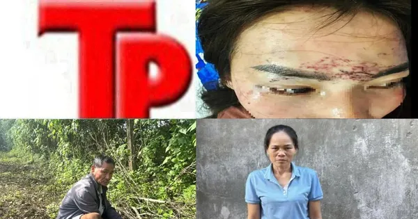 Bản tin Hình sự: Điều tra vụ người phụ nữ bị cướp giật dẫn đến ngã chấn thương sọ não