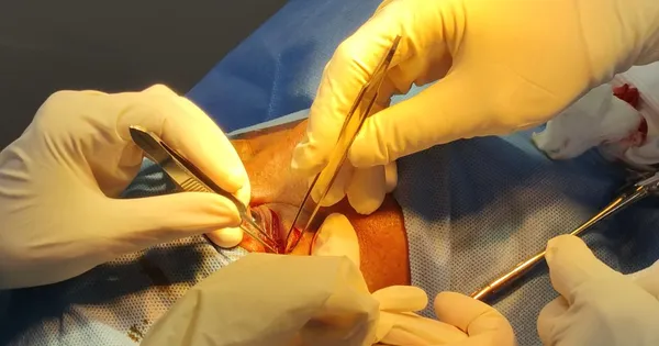 Cứu người đàn ông bị hàng xóm dùng đũa đâm xuyên hốc mắt