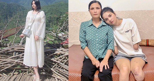 Cô gái Phú Thọ mất tứ chi trong một tháng, được...