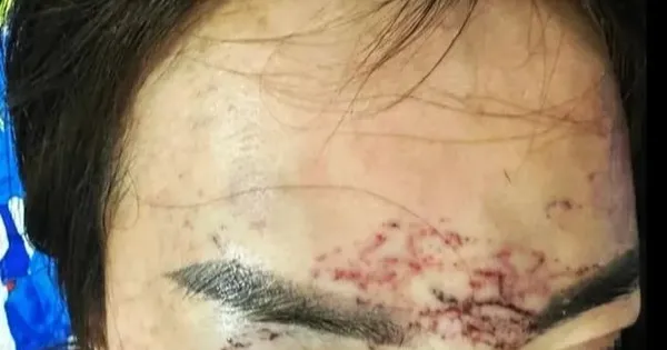 Vụ 'tố' bị bắt giữ, đánh đập, xăm mặt vì ghen: Khởi tố 2 người phụ nữ
