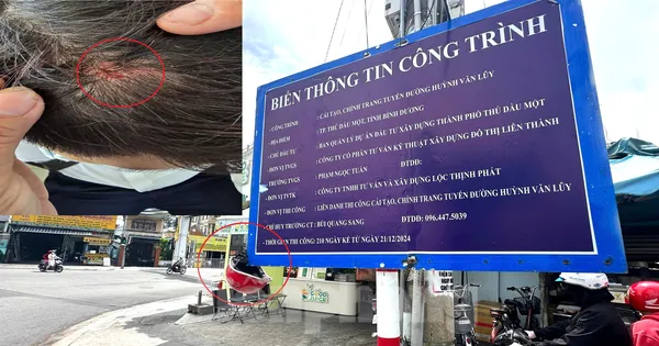Nhiều người đi đường bị chảy máu đầu vì bảng thông tin công trình trên vỉa hè