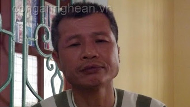 Đời dâu bể của người bị nhổ răng, cắt tai vì ma túy Đời dâu bể của người bị nhổ răng, cắt tai vì ma túy