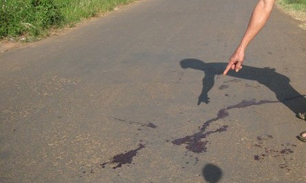 Hãi hùng phát hiện thi thể đứt lìa tay trái Ảnh minh họa