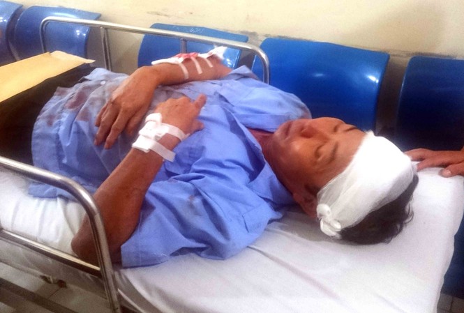 Mới nhất vụ lật xe khách kinh hoàng trên cao tốc Pháp Vân - Cầu Giẽ Nạn nhân đang được cấp cứu trong bệnh viện. Ảnh: Thanh Hà.