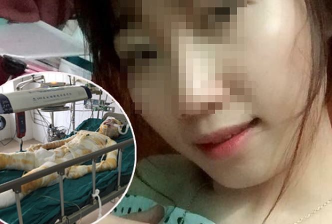 Bắt nghi phạm tẩm xăng thiêu sống hai cô gái trong nhà trọ Chị H trước và sau khi bị tẩm xăng đốt.Ảnh: ANTĐ