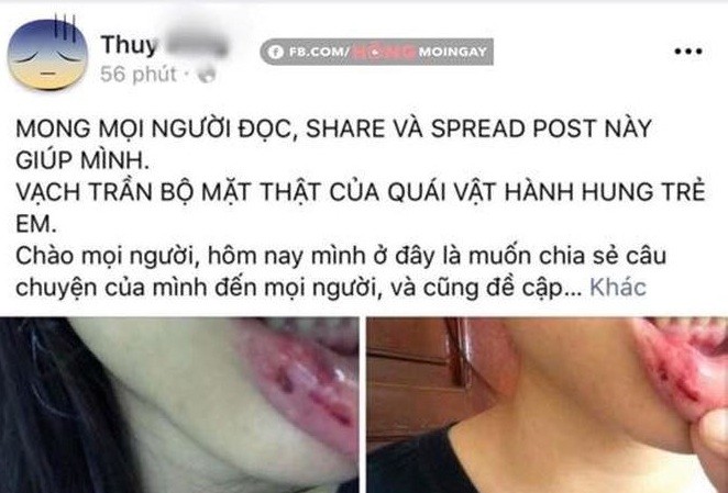 MC Minh Tiệp đối mặt với án phạt nào nếu bạo hành em vợ? Hình ảnh chia sẻ trên mạng xã hội.