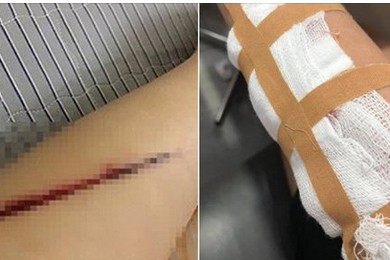 Công an làm việc với người tung tin thiếu nữ bị cướp rạch tay giữa phố Hình ảnh chia sẻ trên mạng xã hội.