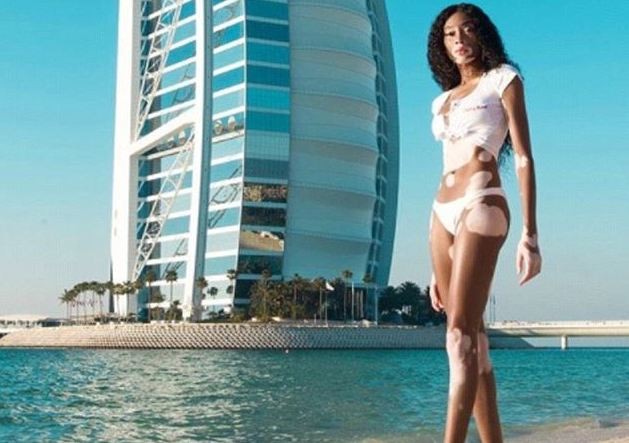 'Siêu mẫu hoang màu' Winnie Harlow đẹp tựa nữ thần trước hoàng hôn 'Siêu mẫu hoang màu' Winnie Harlow đẹp tựa nữ thần trước hoàng hôn