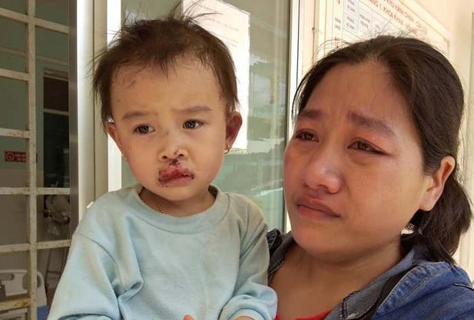 Chồng cụt 2 chân, vợ mang thai chết thương tâm do sập nhà Bé gái thoát chết trong vụ sập nhà. Ảnh H.T