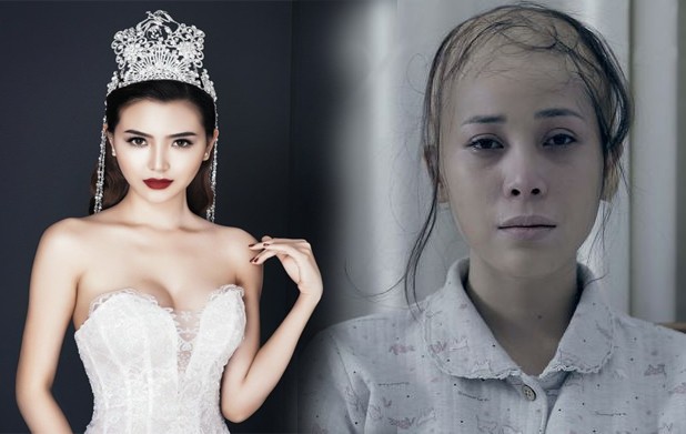 Showbiz 1/6: Sốc với hình ảnh bị ung thư của “Nữ hoàng trang sức” 2018 Showbiz 1/6: Sốc với hình ảnh bị ung thư của "Nữ hoàng trang sức" 2018