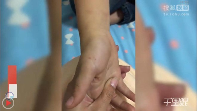 Học sinh tiểu học bị đâm bút chì vào tay khi làm sai bài: Phê bình giáo viên Hình ảnh trích từ đoạn clip do phụ huynh đăng tải. (Nguồn: sohu).