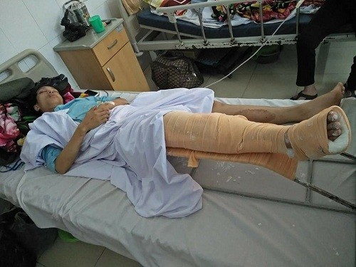 Sắp khởi tố tài xế đâm 7 người thương vong đêm giao thừa Một nạn nhân điều trị tại bệnh viện