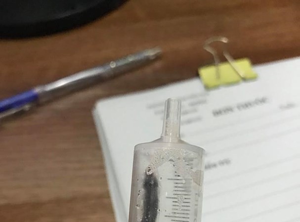Kinh hoàng vắt sống cả tháng trong mũi của bé 8 tuổi Kinh hoàng vắt sống cả tháng trong mũi của bé 8 tuổi