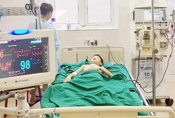 Bé 11 tuổi nguy kịch vì bị ong vò vẽ đốt Bé 11 tuổi nguy kịch vì bị ong vò vẽ đốt