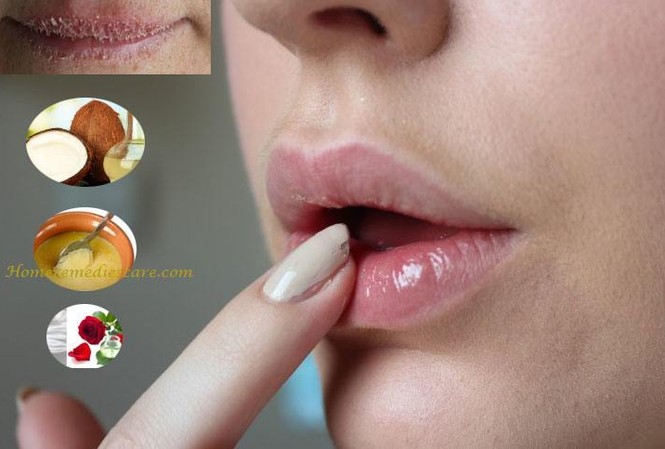 Cách trị bệnh đơn giản mà hữu hiệu tại nhà Ảnh minh họa