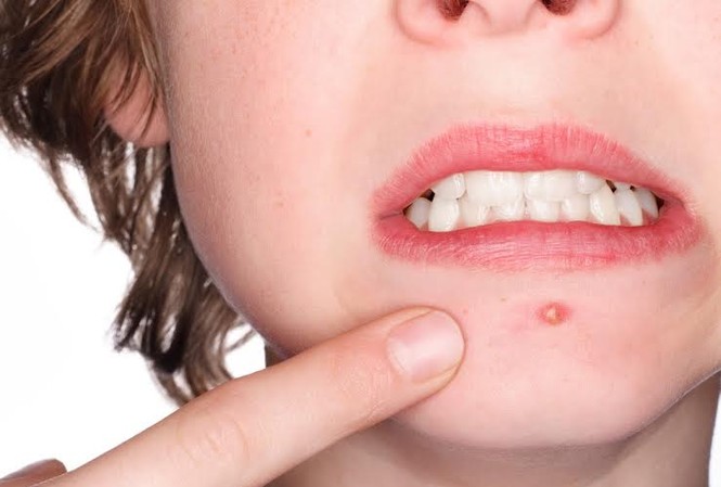 Những biểu hiện khác lạ của cơ thể 'tố cáo' bệnh tật Những biểu hiện khác lạ của cơ thể 'tố cáo' bệnh tật