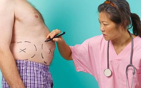 Phẫu thuật giảm cân thông thường dẫn tới các vấn đề tiêu hóa kéo dài Ảnh minh họa
