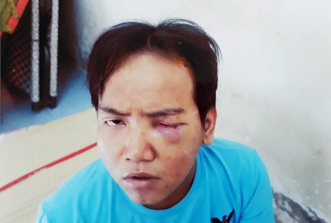 Tâm thần phân liệt nguy hiểm đến mức có thể dẫn đến giết người Giang tỏ ra khá bình tĩnh khi ở trụ sở công an. Ảnh H. Tâm - Pháp Luật TP. HCM