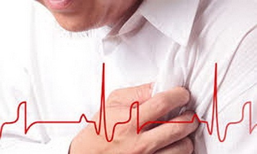 Y tá nam tự cứu sống mình trong cơn nhồi máu cơ tim Ảnh minh họa