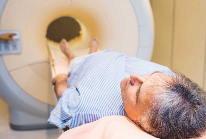 Vì sao nam giới cần thực hiện xét nghiệm ung thư tuyến tiền liệt? Ảnh minh họa: Healthline