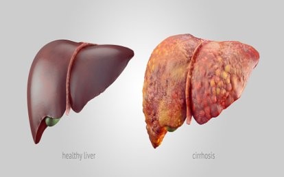 Khi nào người mắc bệnh gan không còn cơ hội cứu chữa? Ảnh minh họa: Bel Marra Health