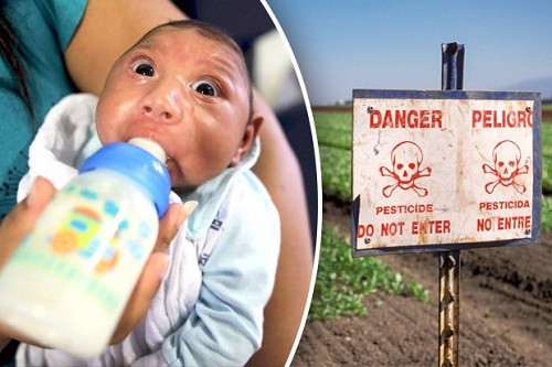 Tranh cãi virus Zika hay thuốc trừ sâu gây bệnh đầu nhỏ ở trẻ Dị tật đầu nhỏ ở trẻ sơ sinh trở thành nỗi ám ảnh ở Brazil. Ảnh: Inquisitr.