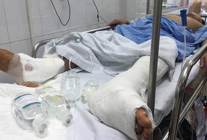 Bệnh nhân đau chân trái, bệnh viện mổ chân... phải Bệnh nhân mổ một chân thành mổ 2 chân do sai sót của kíp mổ. Ảnh: Nguyễn Hoàn.