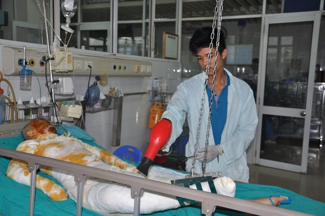 Nữ sinh gặp tai nạn bỏng xăng kinh hoàng Nhận được tin mẹ, chị gái và em trai đều bị bỏng, em trai thứ 2 là Nguyễn Văn Thuận đang là sinh viên năm 3 trường ĐH Tôn Đức Thắng phải đi từ trong Sài Gòn ra Hà Nội để cùng bố chăm chị gái.