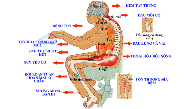 Nhiều nguy cơ khó lường vì ngồi nhiều Nhiều nguy cơ khó lường vì ngồi nhiều