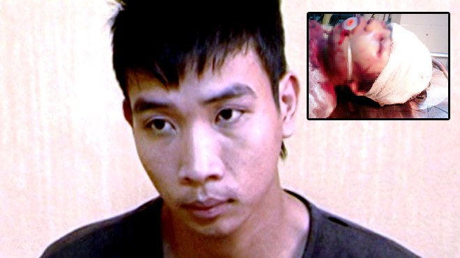 Kẻ đánh dã man bé 14 tuổi khai gì tại công an? Nghi phạm đánh dã man bé 14 tuổi ở Thanh Hóa và Bé gái Đỗ Thị Oanh bị đánh vô cùng dã man với nhiều vết thương trên đầu và mặt (Ảnh gia đình cung cấp)