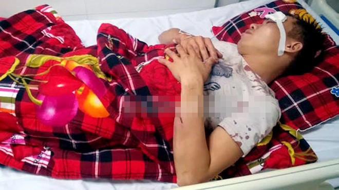 Hàng chục kẻ bịt mặt xông vào nhà dân truy sát Nạn nhân đang được điều trị tại BVĐK Cửa Đông