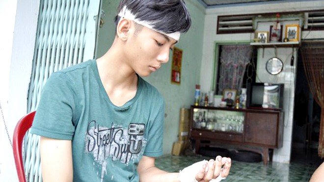 Vụ vào UBND phường chém người: Xác định 7 đối tượng Nạn nhân Quang bị chém vào đầu và tay đang được điều trị