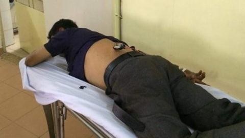 “Cẩu tặc” dùng súng điện bắn trọng thương người dân Anh Khải thời điểm được người nhà đưa vào BV Đ khoa khu vực Thủ Đức cấp cứu với mũi tên súng điện còn cắm chặt trên lưng. Ảnh Đ.T