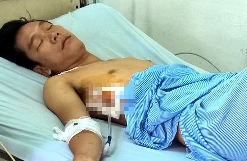 Người cho thuê xe điện cân bằng bị du khách đánh chết Anh Thương đang điều trị ở bệnh viện. Ảnh: Xuân Thắng