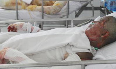 Nạn nhân bị người tình tưới xăng đốt giữa Sài Gòn đã tử vong Nạn nhân bị người tình tưới xăng đốt đã tử vong