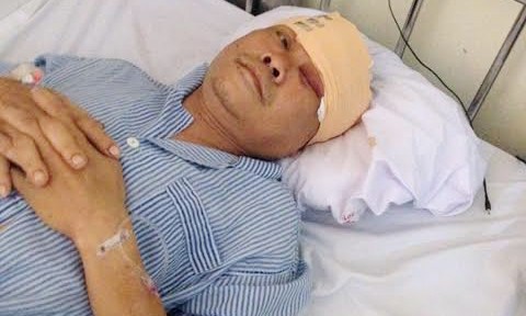 Trung tá công an bị chém trọng thương Trung tá Hưng sau khi bị chém vẫn cố gắng phối hợp cùng mọi người bắt đối tượng