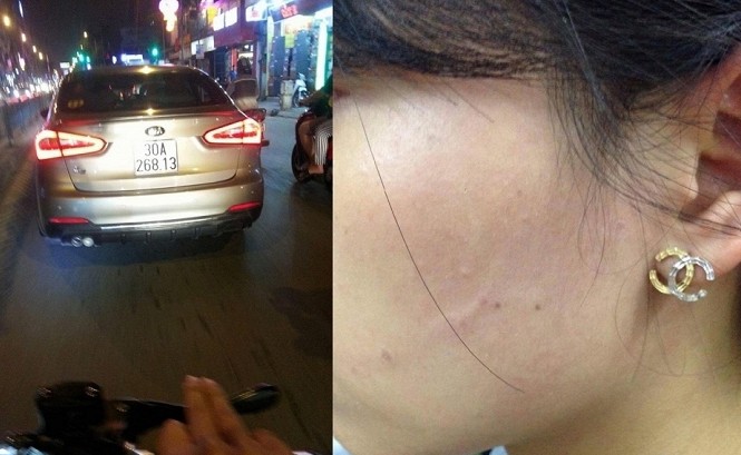 Công an triệu tập tài xế ô tô tát cô gái vì Tài xế xe hơi tát cô gái vì không nhường đường được công an mời lên làm rõ